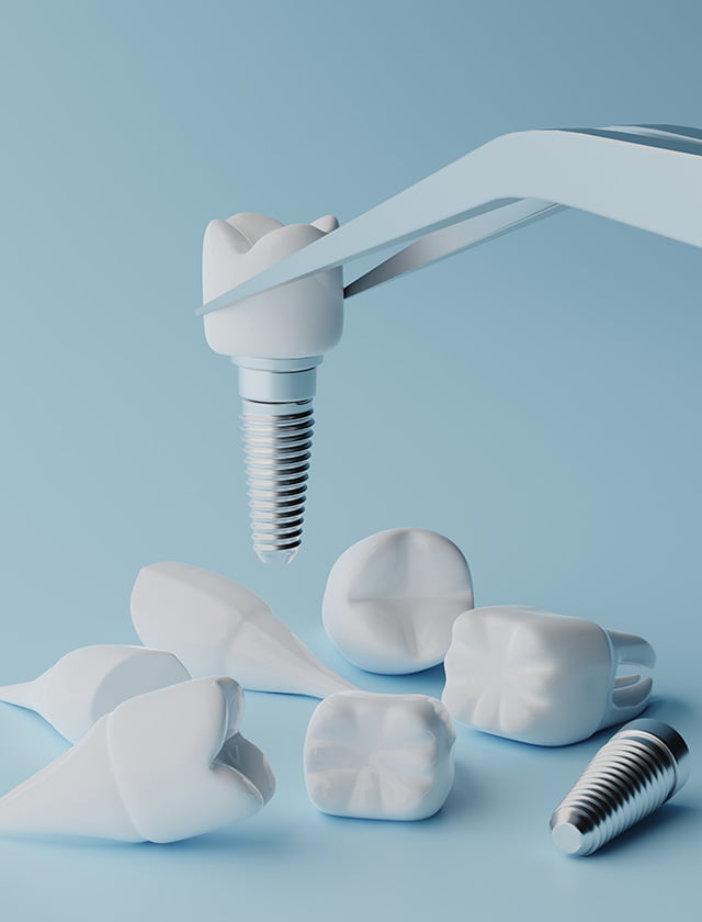 implantaten